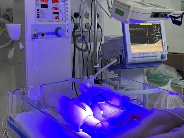 Hospital Regional do Sudoeste implanta UTI Neonatal&nbsp;Neurológica