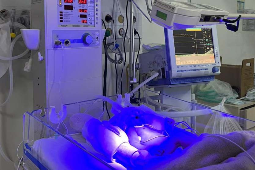 Hospital Regional do Sudoeste implanta UTI Neonatal Neurológica